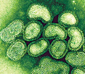 Is this what the swine flu virus looks like? I'm not sure. Does this image come up when you Google 'swine flu'? You're damn right it does.